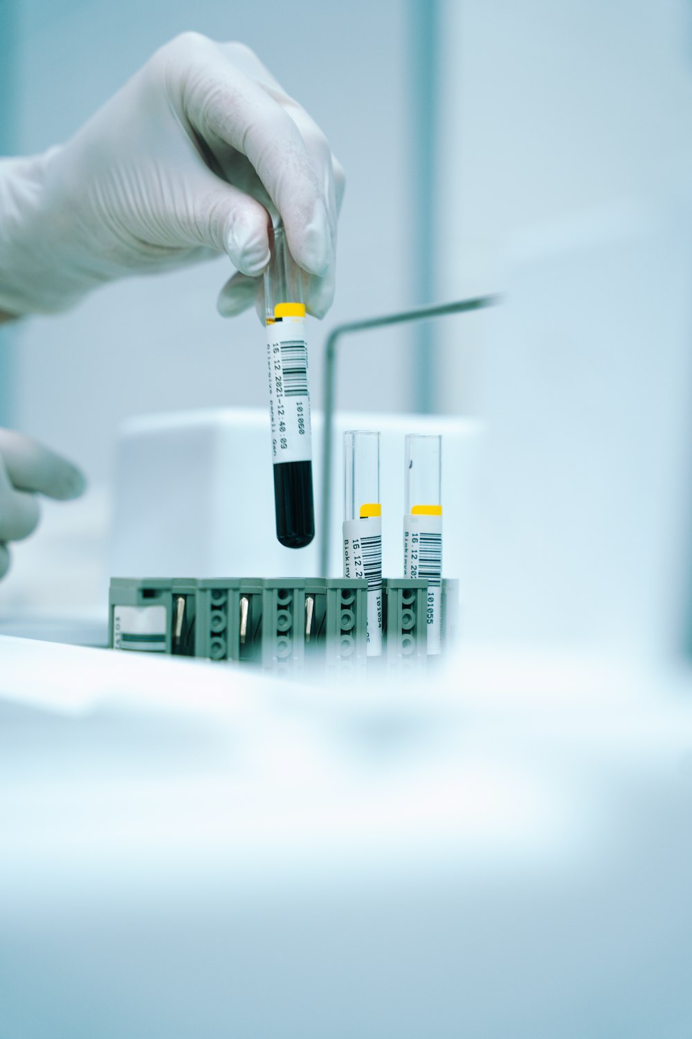 Amostra de sangue sendo coletada para exame